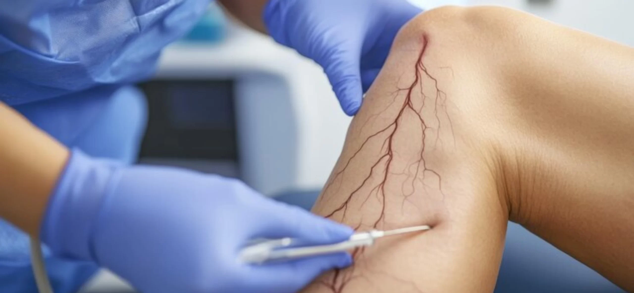Oakbrook Vein Centers